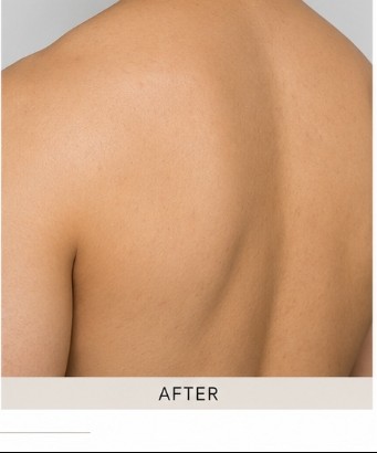 After Intimate Wellness by EmFemme 360